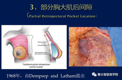 胸手术游戏,探索胸手术游戏带来的医学教育革新