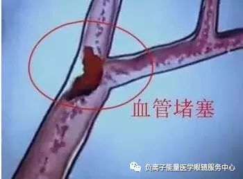 打游戏血管,探索虚拟与现实交织的血管生成之旅