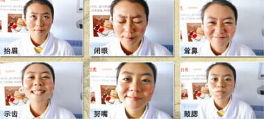 面瘫恢复游戏,游戏助力重拾微笑
